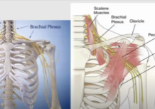 Arielle Levy diagram of shoulder muscles and nerves